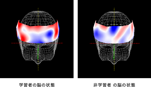 学習者により多くの血流(赤色)が見られる